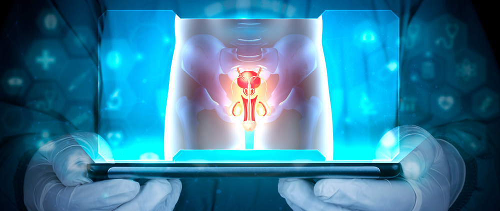 Hydrocele-treatment-without-surgery-in-adults